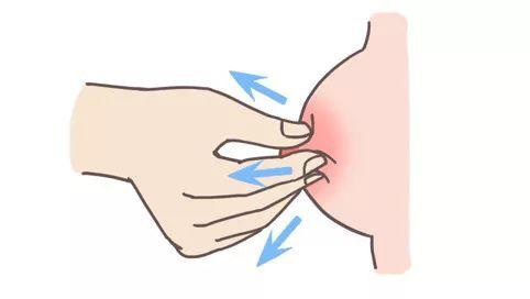 哺乳期奶结硬块很痛消除最好办法,哺乳期消除奶结硬块按摩穴位