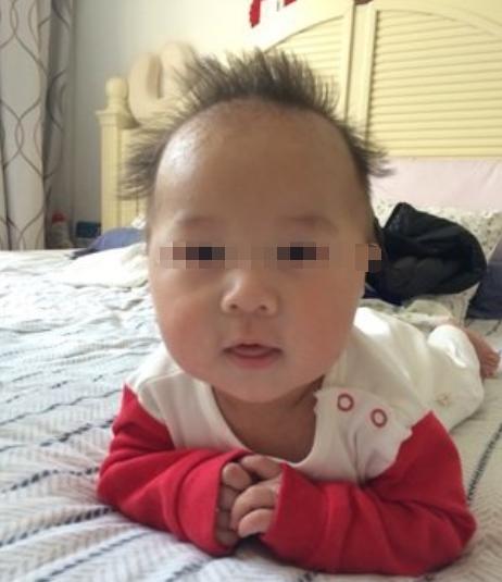 小孩头发像刺猬一样什么原因,小宝宝头发一绺一绺的是怎么回事