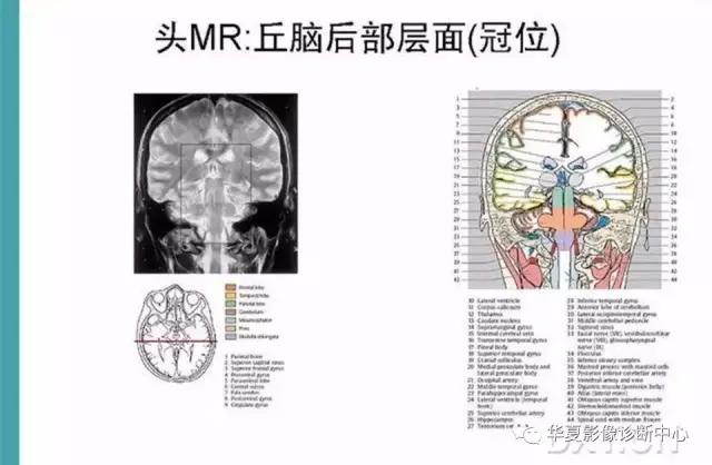 mra头颅解剖学详细讲解视频,常见的头颅mri图像