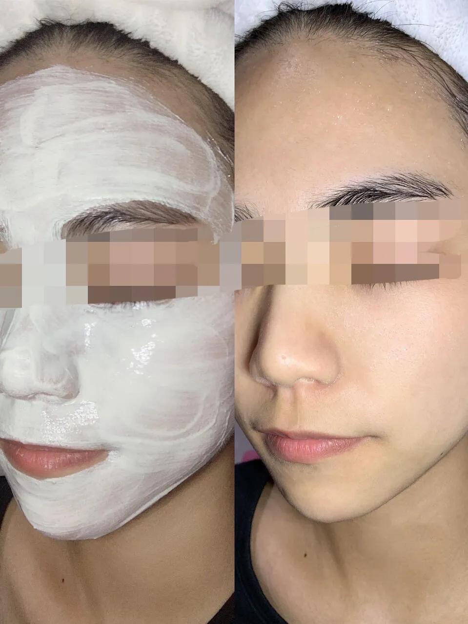 好用的去除黑头小妙招,去除黑头小窍门一招解决