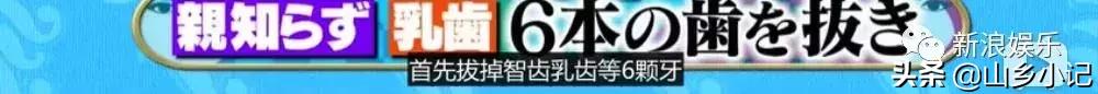明明是整容脸现在却成了颜值巅峰,明明是整容脸却没被吐槽过
