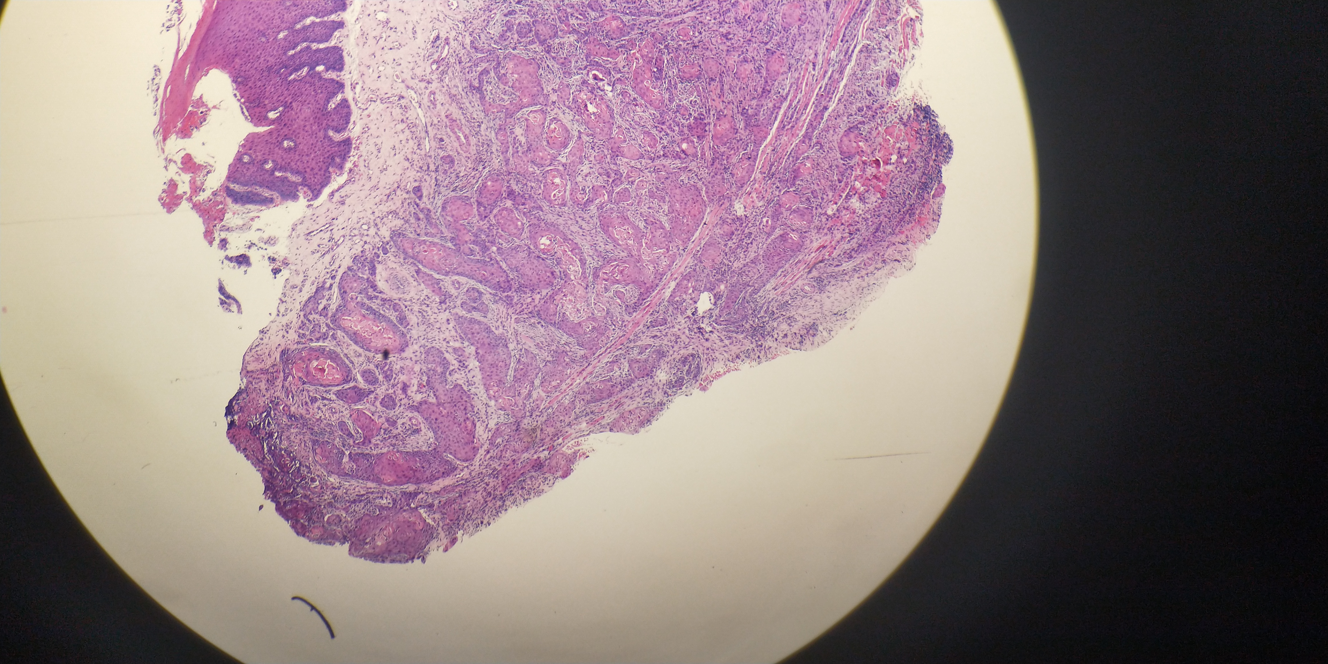吃槟榔是需要削骨吗,吃槟榔用剥皮吗
