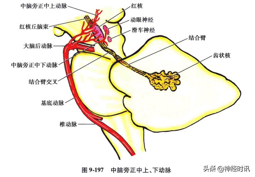 急性脑血管病的解剖诊断,脑的血液供应来源及脑血管的特点