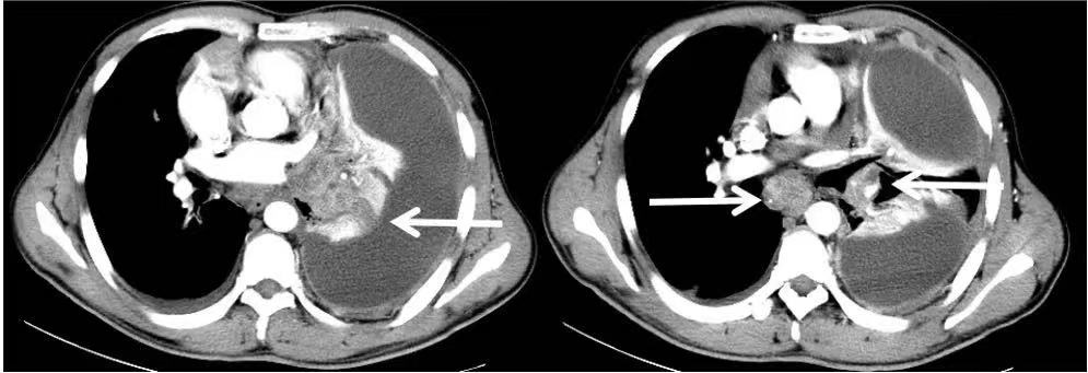 绁炶嵂鍥戒骇,鑽鎵撴灦鐗囨