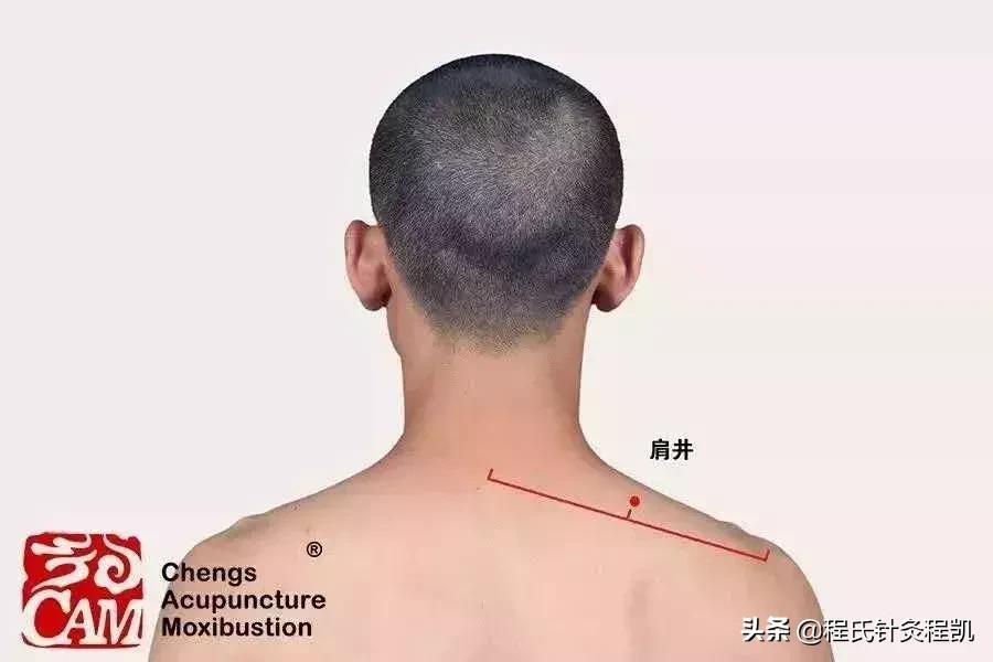 颈肩综合症的七大症状,颈肩并发症该如何治疗