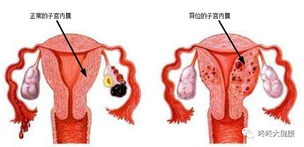 想要好孕小心这6个隐患,想要好孕都有什么秘诀吗