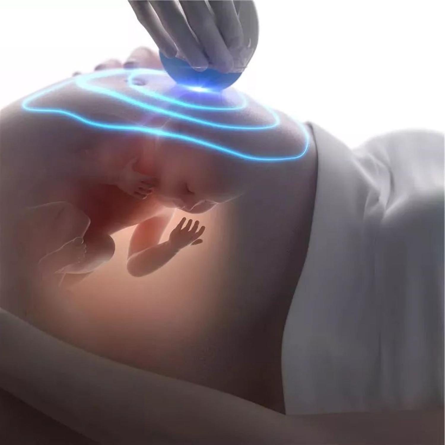 怀孕了羊水是有什么用的,为什么羊水称作羊水