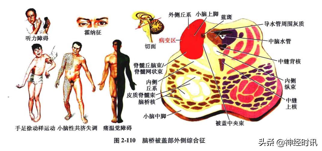 脑干解剖,脑干神经解剖