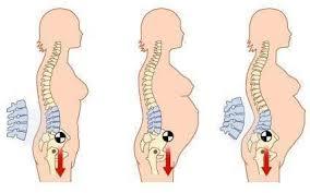 产后腰痛做什么动作可以缓解腰痛,产后腰痛的治疗缓解方法