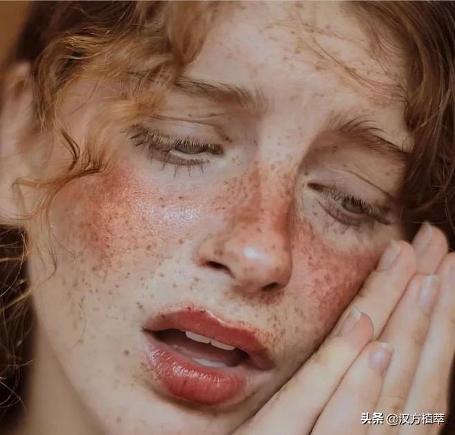 做斑一年了皮肤有点红,做斑后会变得很老吗