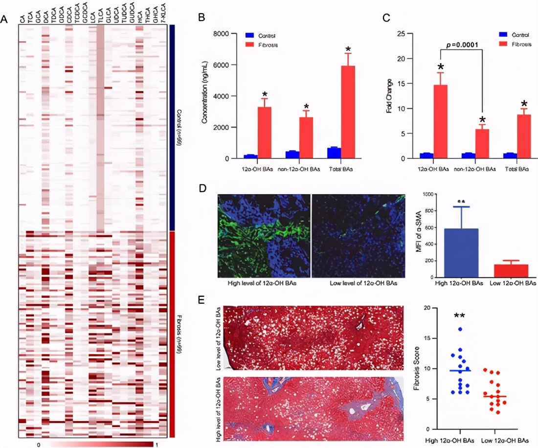 胆汁酸代谢障碍发生机制,胆汁酸代谢和脂质代谢