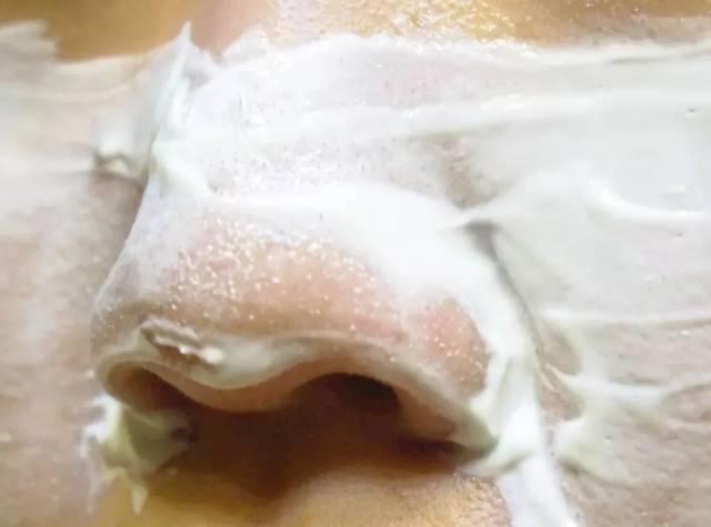 教你科学去黑头从此告别草莓鼻,去黑头的最好方法神器