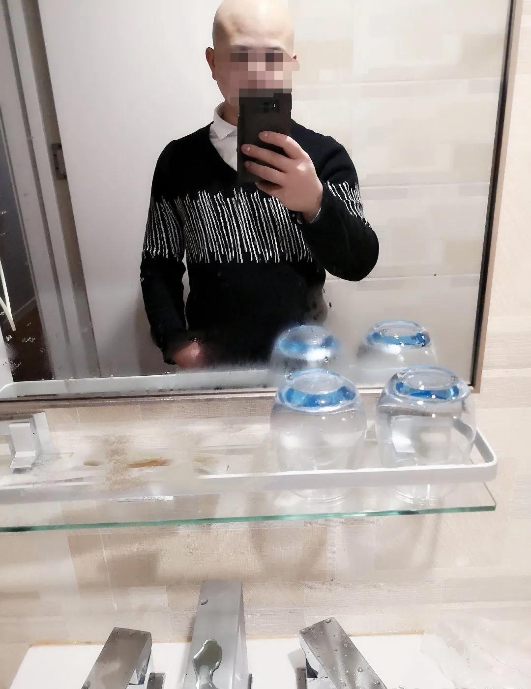 江西小伙患癌28年了,江西小伙得白血病