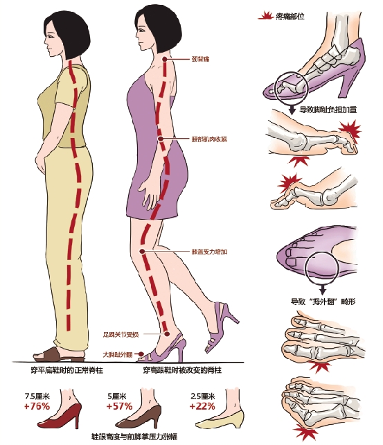 扁平足穿什么鞋都痛吗,扁平足穿什么鞋可以矫正
