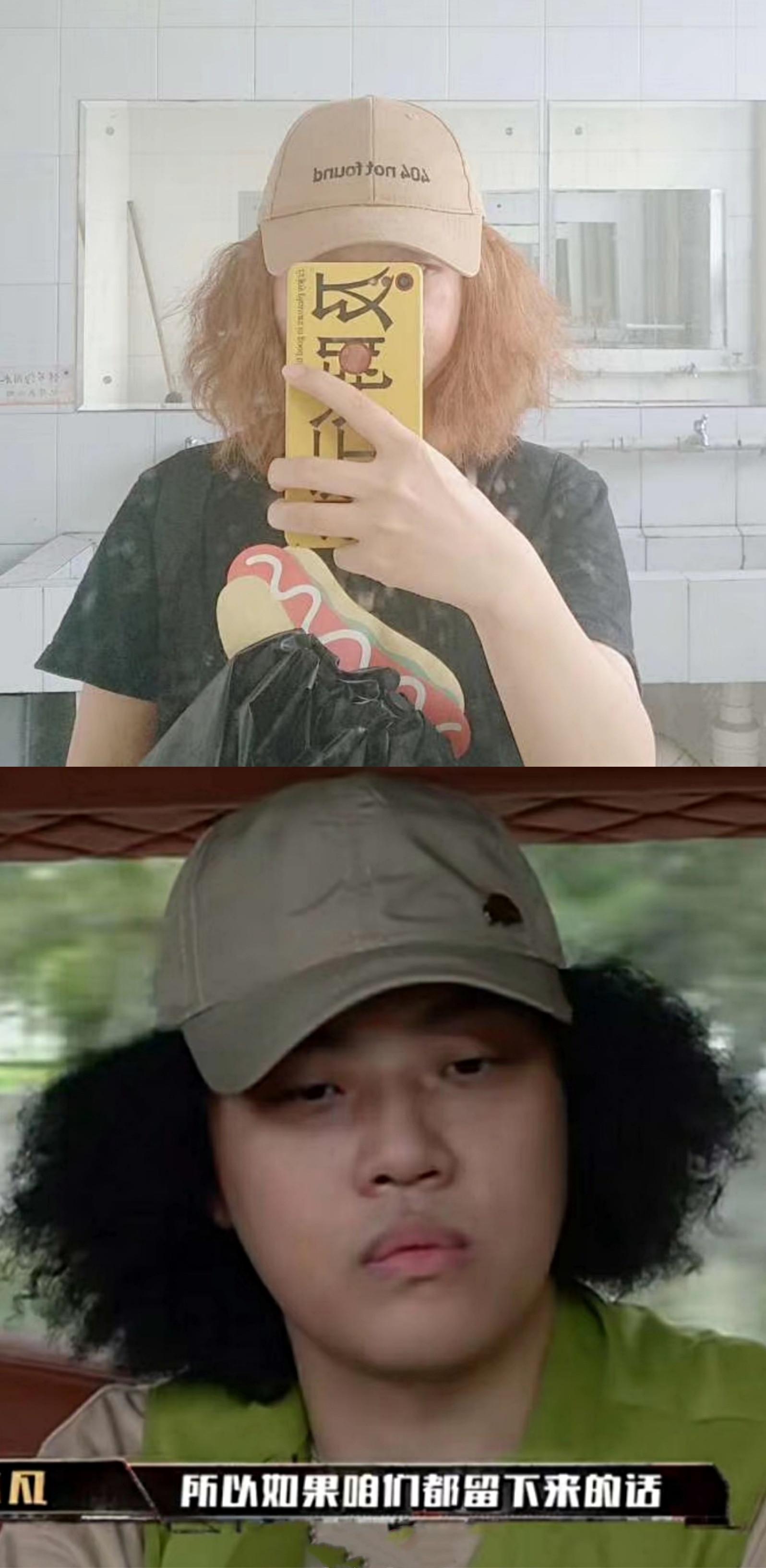 被发质问题困扰,被头发困扰20多年