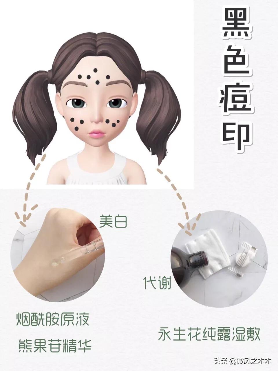 痘印痘坑消除要做多少次医美,去痘印痘坑痘疤的医美方法