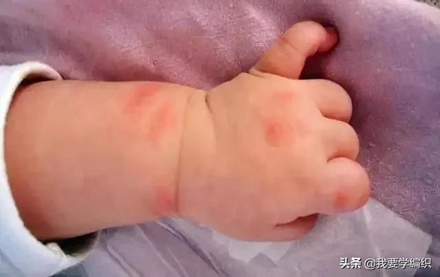 你知道蚊子为什么被扇吗,蚊子除了怕蚊香害怕什么