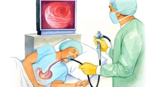 贲门紧缩术能彻底治愈食管反流吗,巴雷特食管能做贲门紧缩术吗