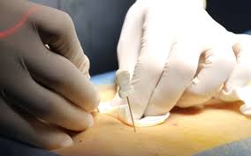 颈腰椎病的最佳锻炼方法,颈椎病和腰椎病的治疗方法