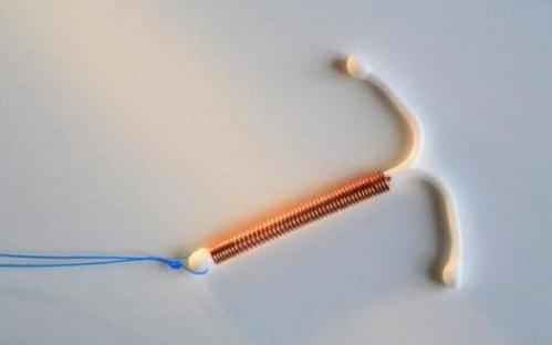 上环后月经推迟一周会不会怀孕,上环后月经会推迟多久呀