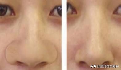 好看的鼻子要有哪些特点,很自然又好看的鼻子