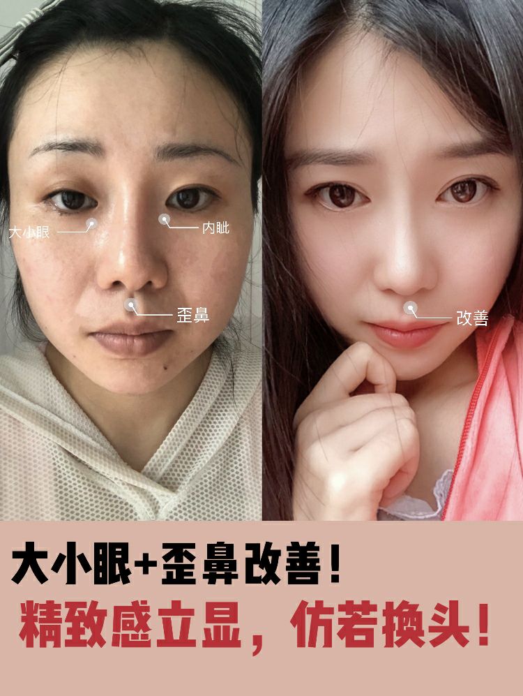 大小眼+歪鼻改善！精致感立显，仿若换头！