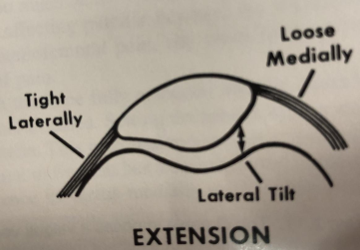 膝盖附近疼是髌骨软化症引起的吗,髌骨膝前疼痛综合症