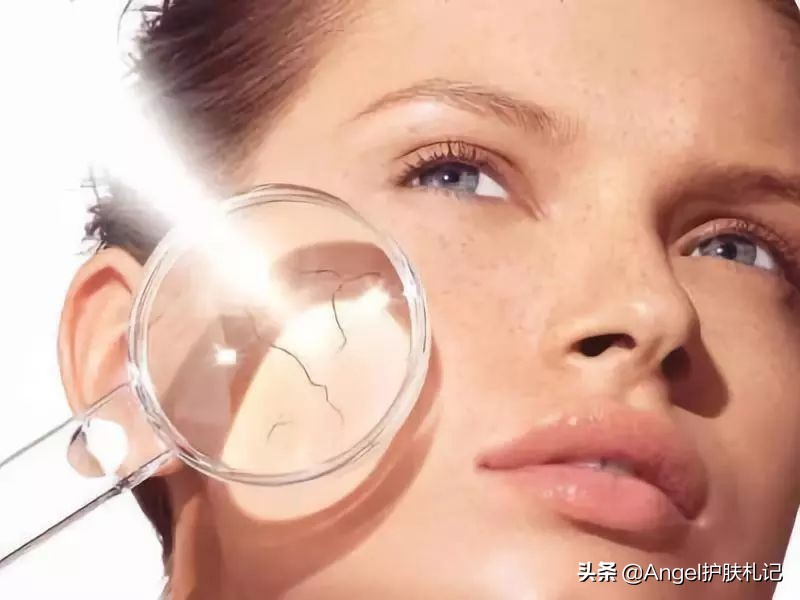 如何修复晒黑的皮肤,多年晒黑的皮肤还有救吗