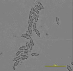 甜樱桃轮纹病,甜樱桃根腐是什么原因