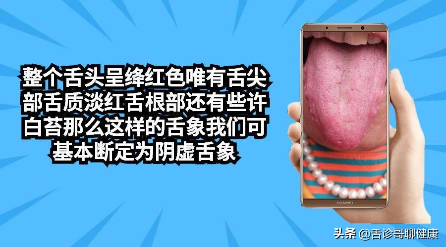 舌诊歌舌象分析与感悟,抖音舌诊哥舌象分析