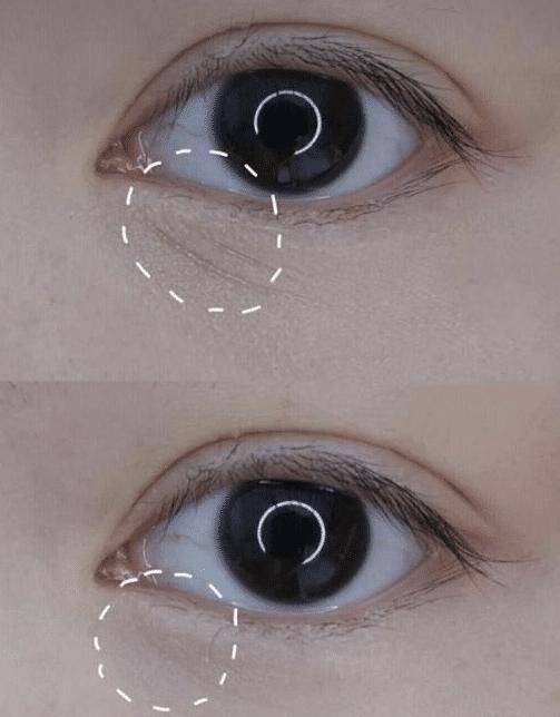 戚薇万能的眼霜,戚薇用的万能眼霜