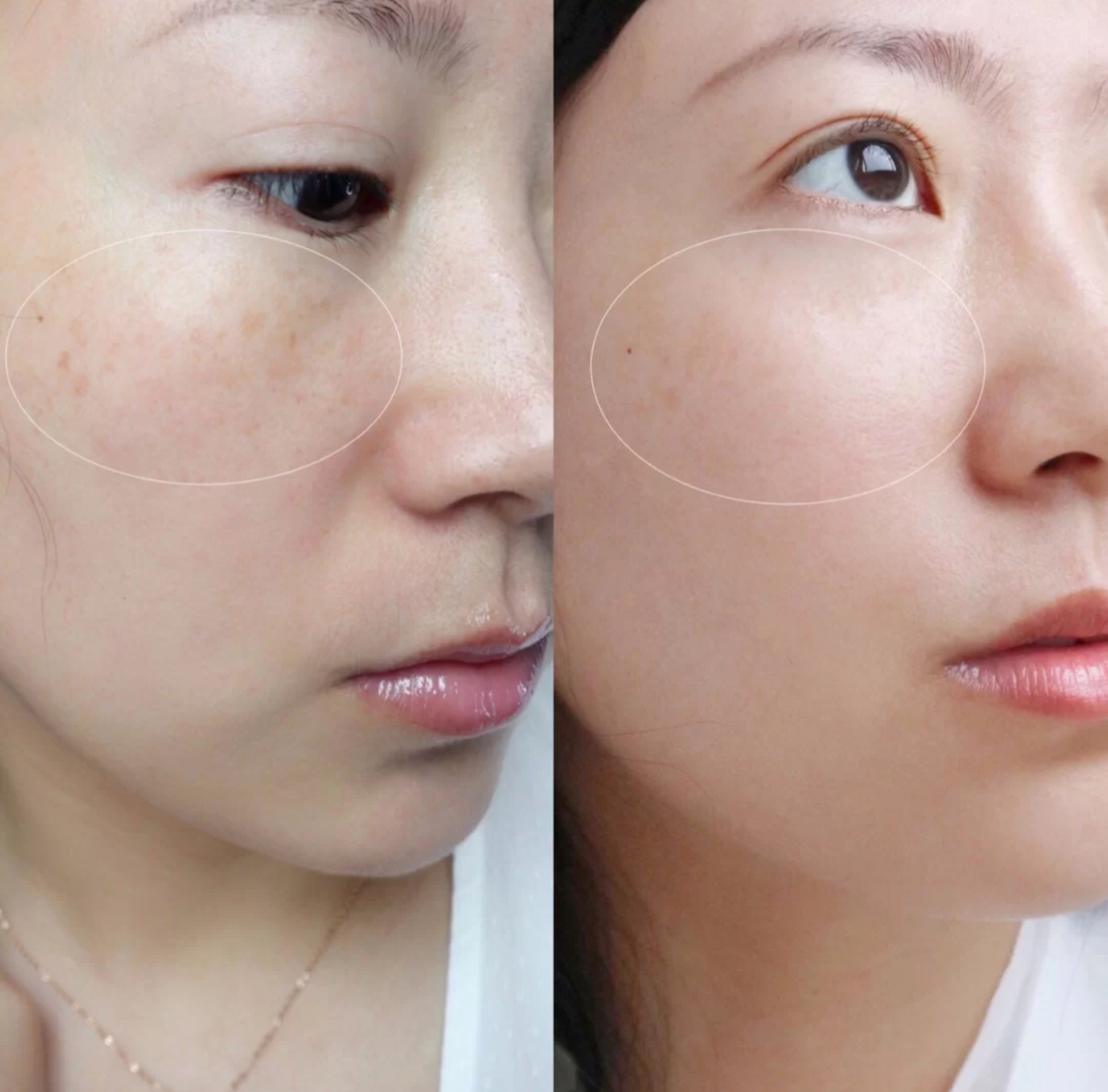 大名鼎鼎的四款美白精华,公认好用的美白提亮精华合集