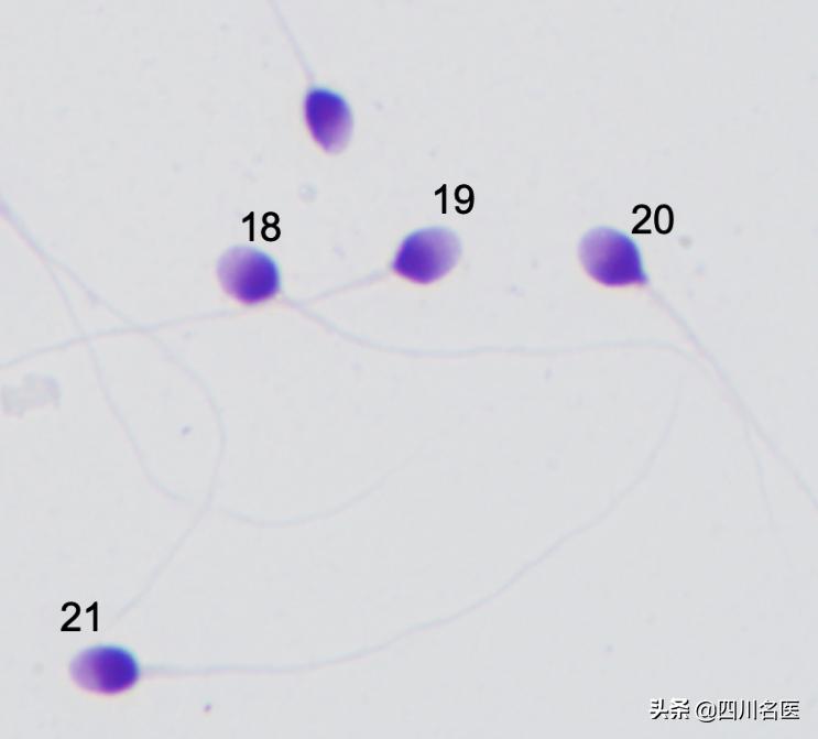 精子是如何产生的百科,精子是不是每天都能生成