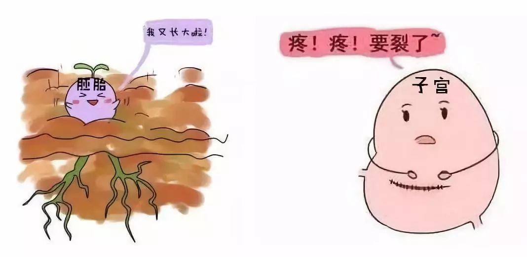 瘢痕妊娠是什么意思,瘢痕妊娠是什么