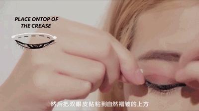 多层眼皮是如何修复的,多层眼皮该怎么消除