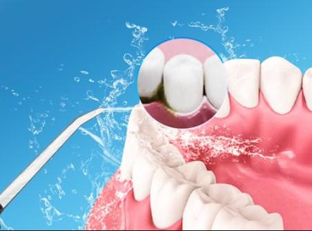 牙齿松动，难以避免的中年危机？慌了