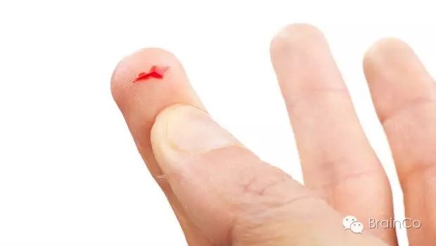 被纸割伤为什么那么疼?解密你的神经与大脑