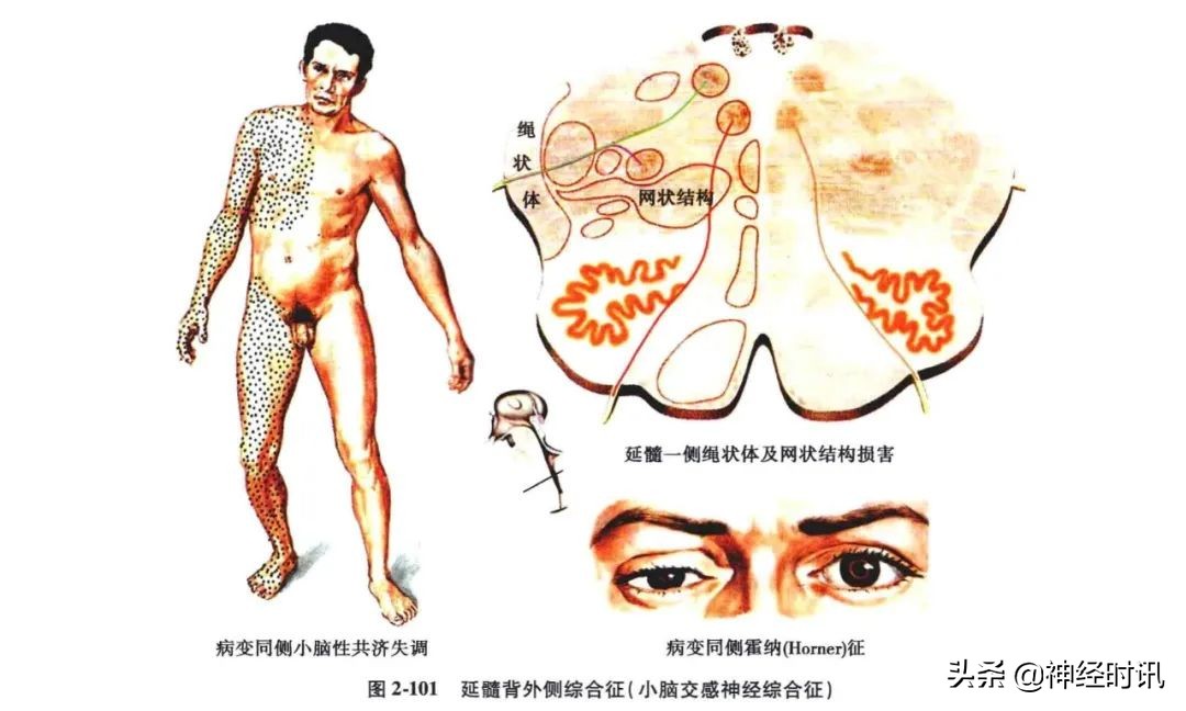 脑干解剖,脑干神经解剖