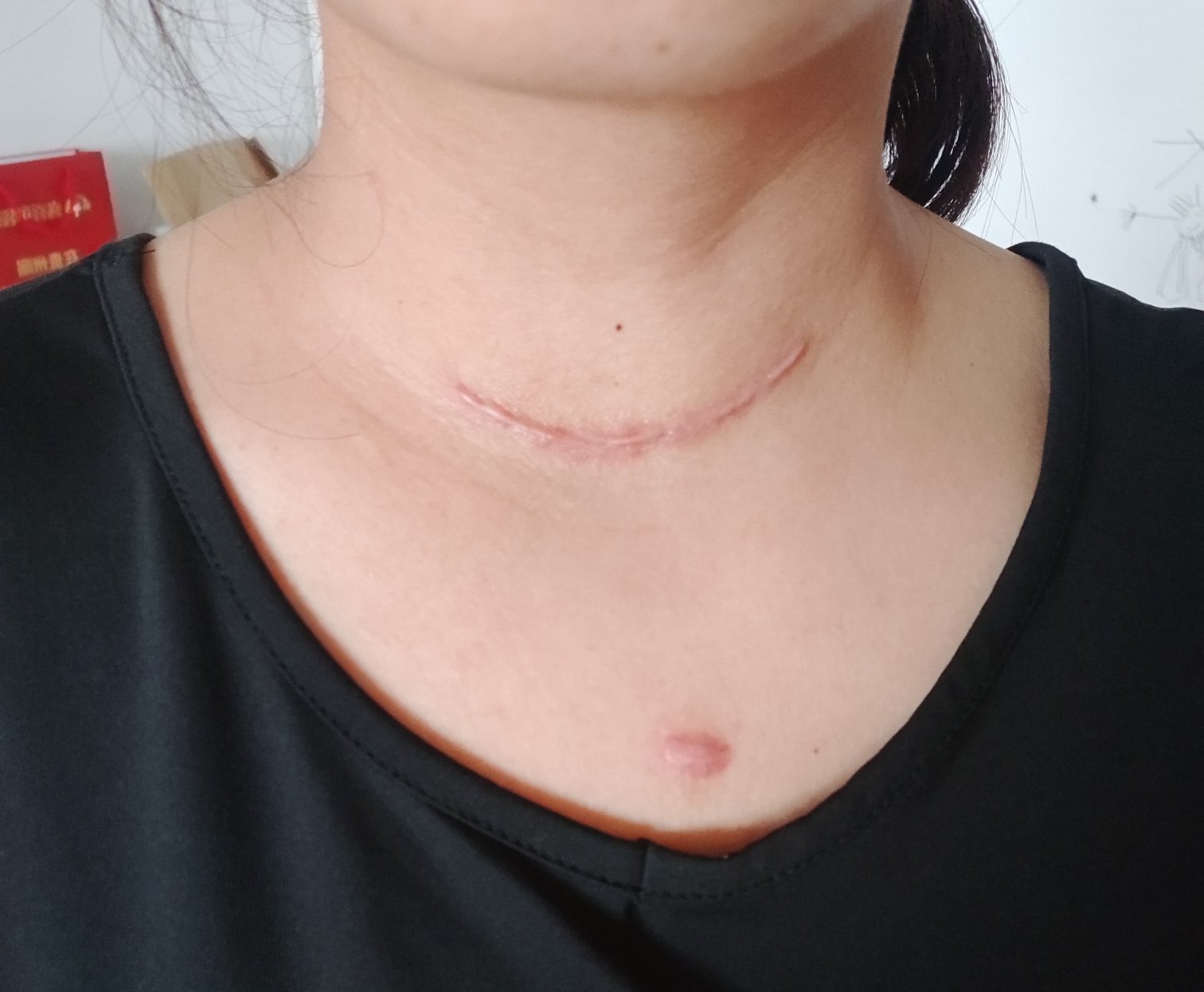 保定慢保卡怎么办理,办慢保卡需要什么材料