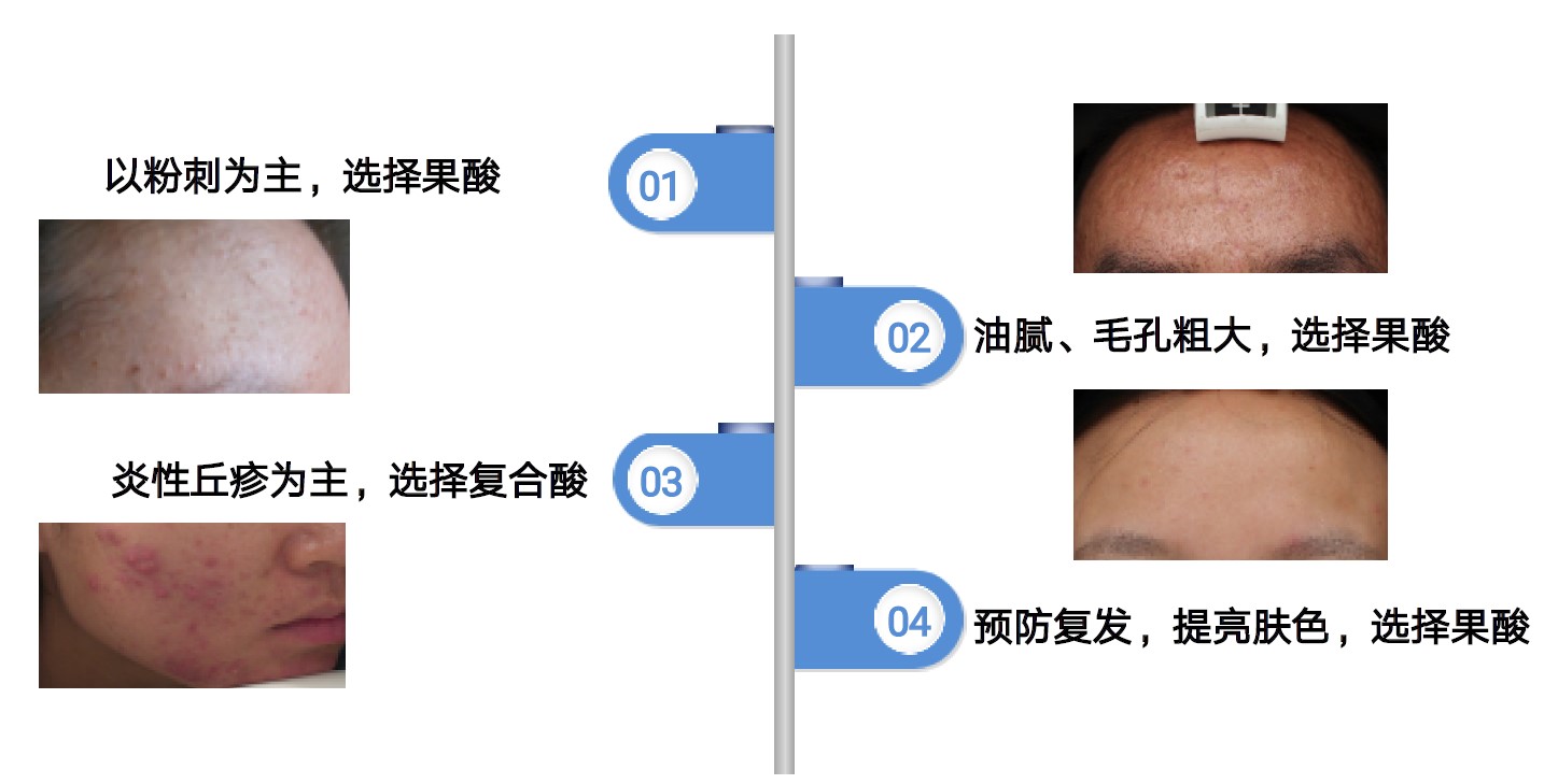 水杨酸和果酸哪个祛黑痘印,祛痘用果酸好还是水杨酸
