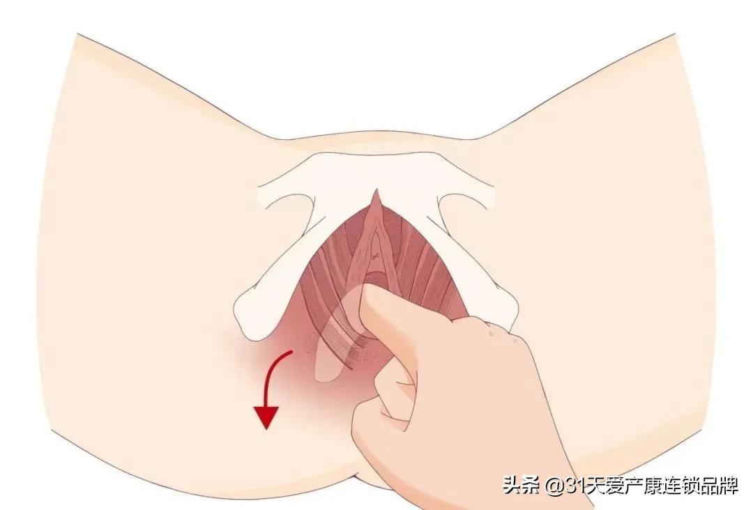 盆底康复运动操,恢复盆底操