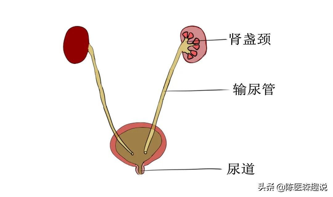 0.7厘米的肾结石怎么治疗好,0.7cm不痛肾结石最佳处理方案