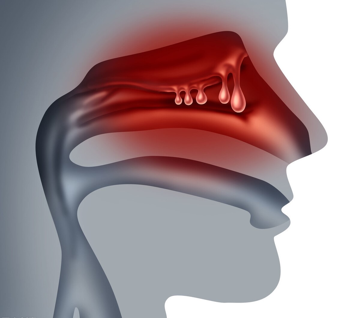 感冒鼻涕由清变黄是哪种感冒,鼻涕由清变黄再变清说明什么