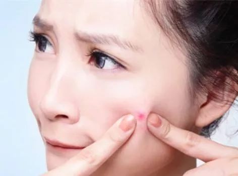下巴闭口粉刺怎么可以有效的去除,痘痘粉刺闭口怎样护肤