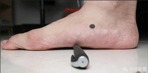 专门改善扁平足的运动,站着改善小腿外翻