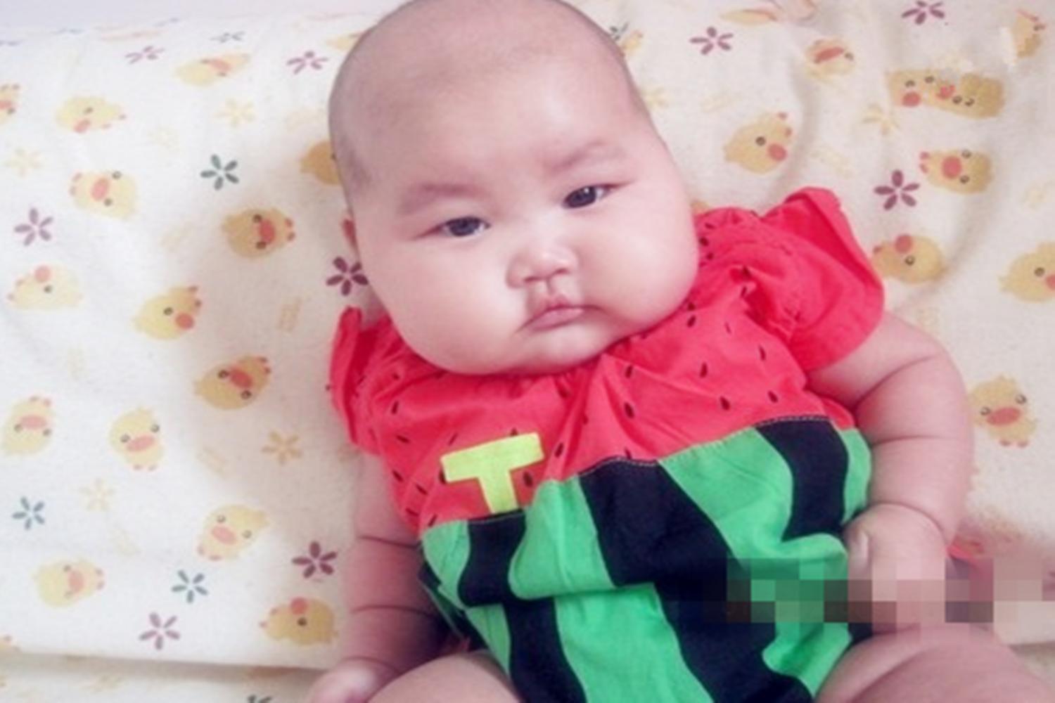 宝宝营养不良面黄肌瘦,宝宝偏食肥胖