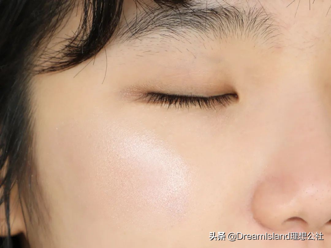 玻尿酸高光排名,打玻尿酸高光推荐