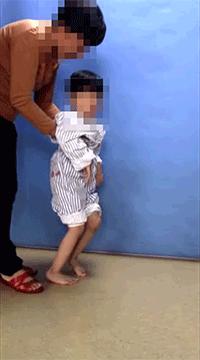 手术康复一体化,脑瘫康复训练10个方法图片