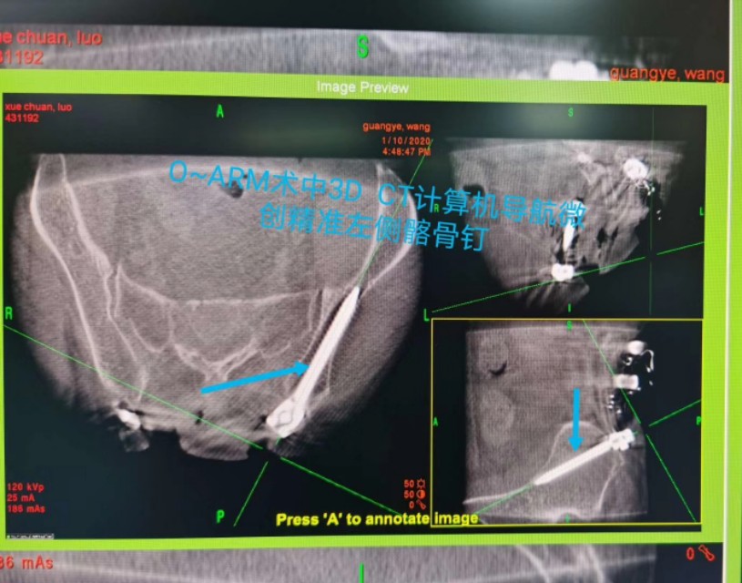 牙齿不好引发的疾病视频,牙齿有问题不做根管治疗会怎么样