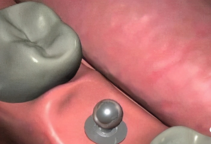 上海雅悦齿科种植牙价格,雅悦齿科医院简介